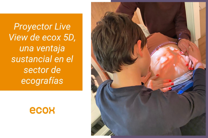 Proyector Live View de ecox 5d. La tecnología al servicio de las emociones.